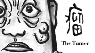 如果你和别人不一样......《瘤》