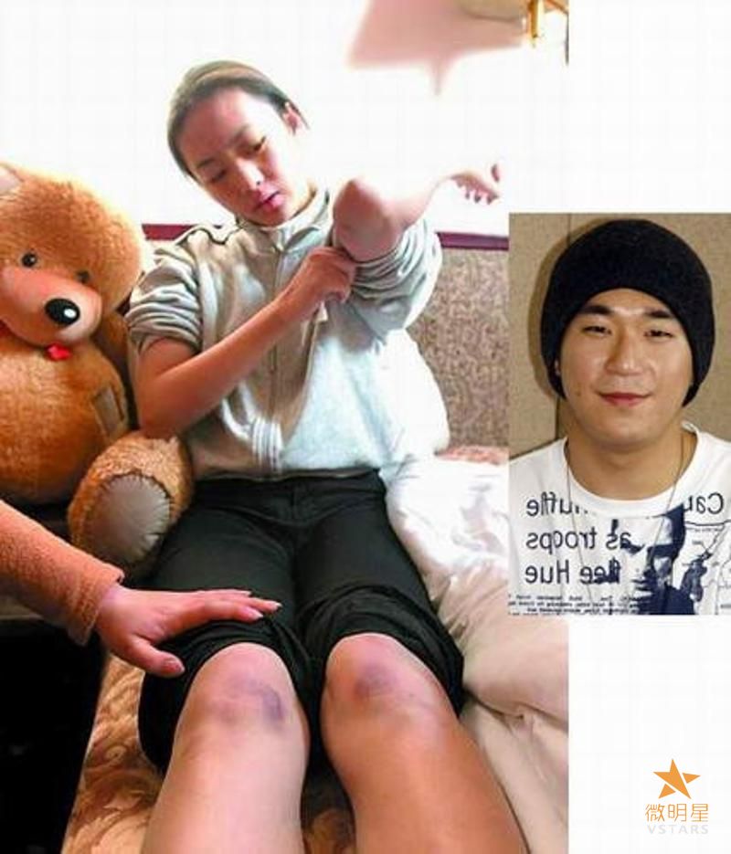 微明星网 张默 张国立 李双江 吸毒 星二代